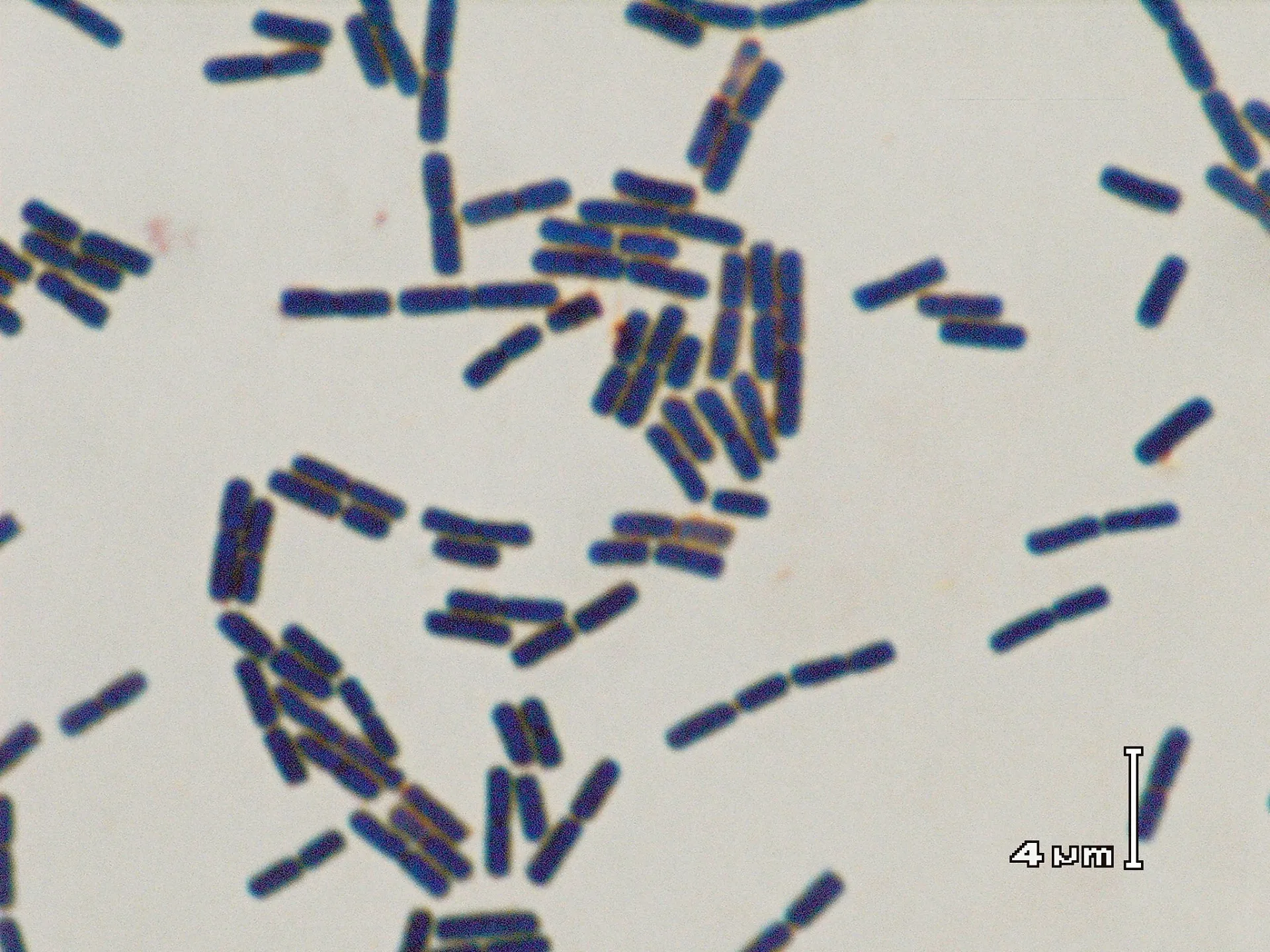微生物の力: 土壌の健康と生態系を守る秘訣