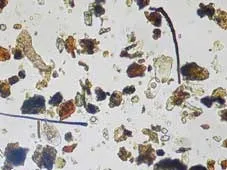 土壌微生物の種類とその驚くべき役割：健康な土壌を作る微生物たち