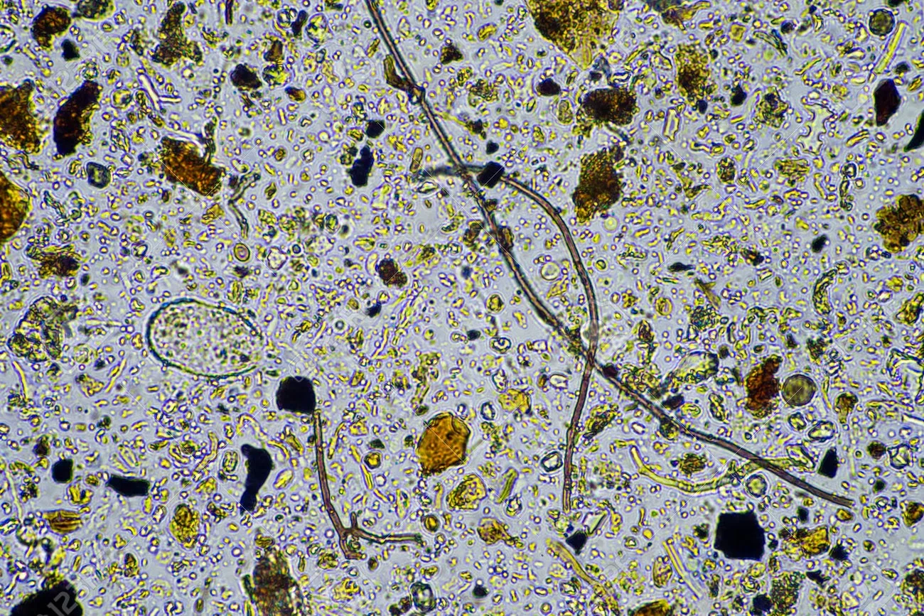 土壌微生物が拓くバイオリメディエーションの未来：持続可能な環境修復への道